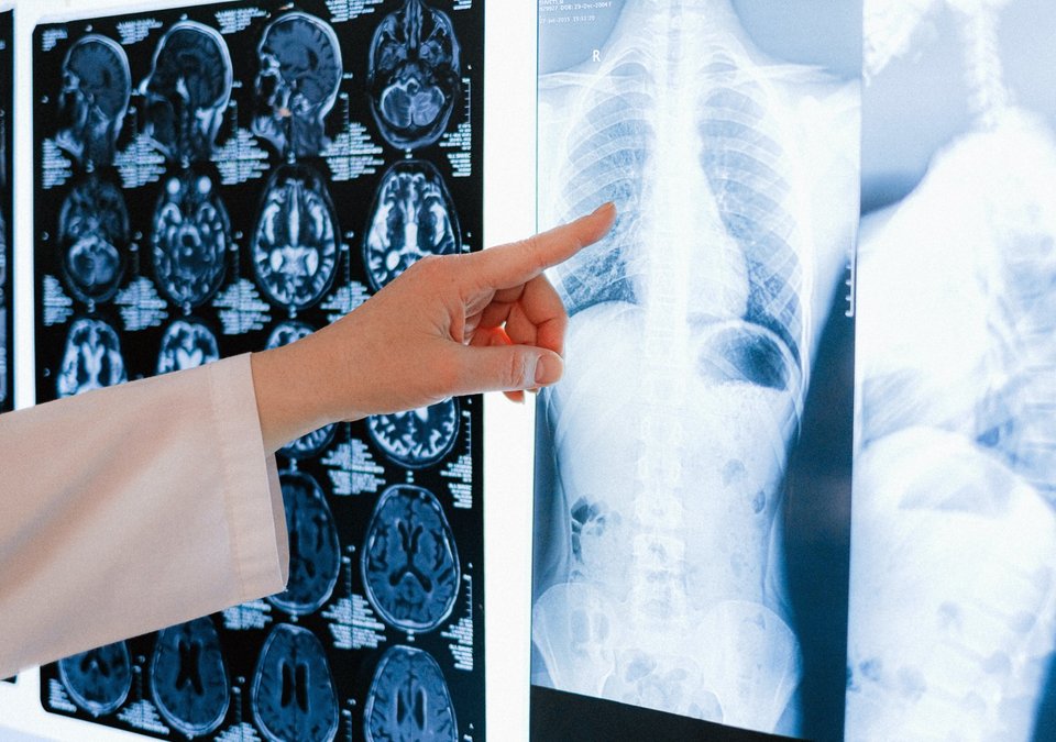 The difference between emphysema and bronchitis