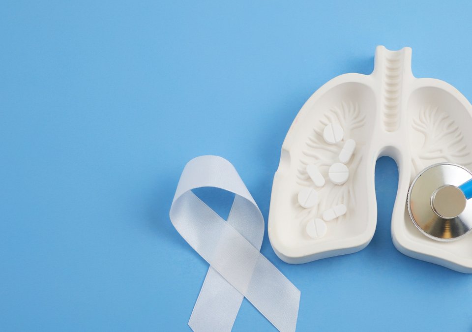 What Evidence Can Help Support a Pneumoconiosis Claim?