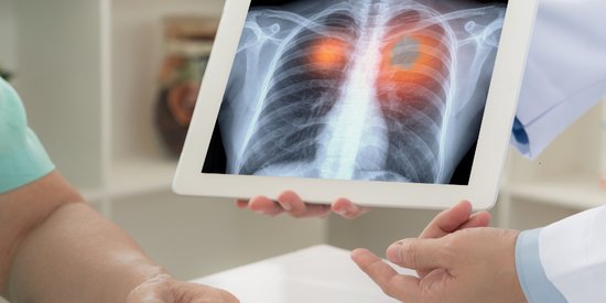 What Can Ex-Miners Claim for Black Lung Disease? UK Compensation Guide