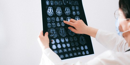 Traumatic Brain Injury Claims: How we can help